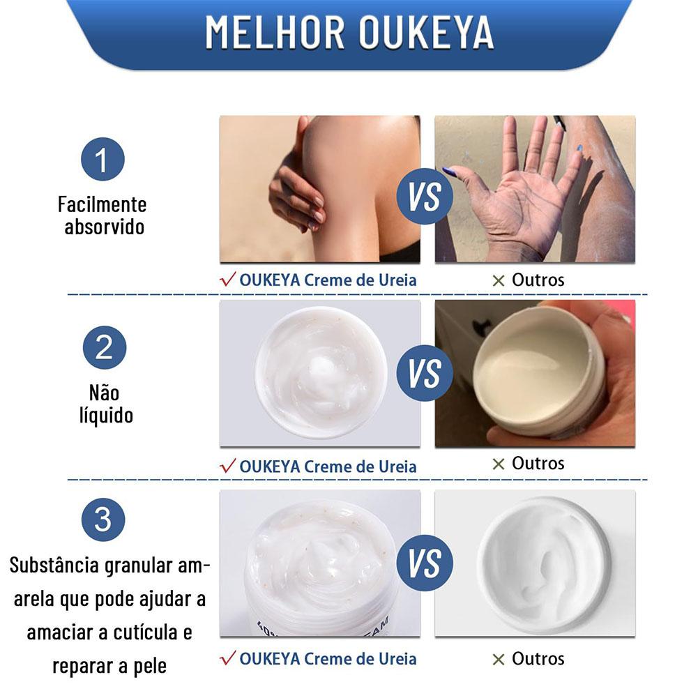 Urea Cream 40% Moisturizing An - Urea Foot Cream review and price