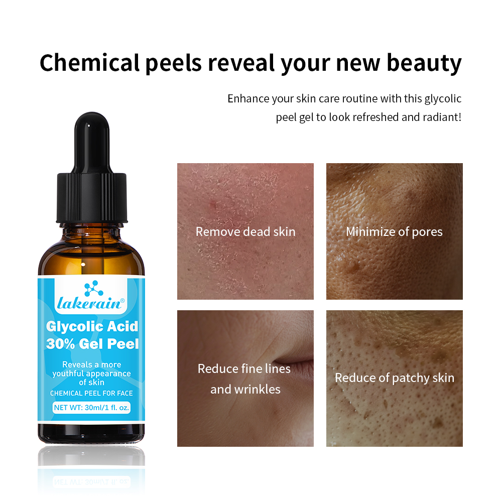30% Glycolic Acid Peel Gel Pro - Lactic Acid Toner review and price