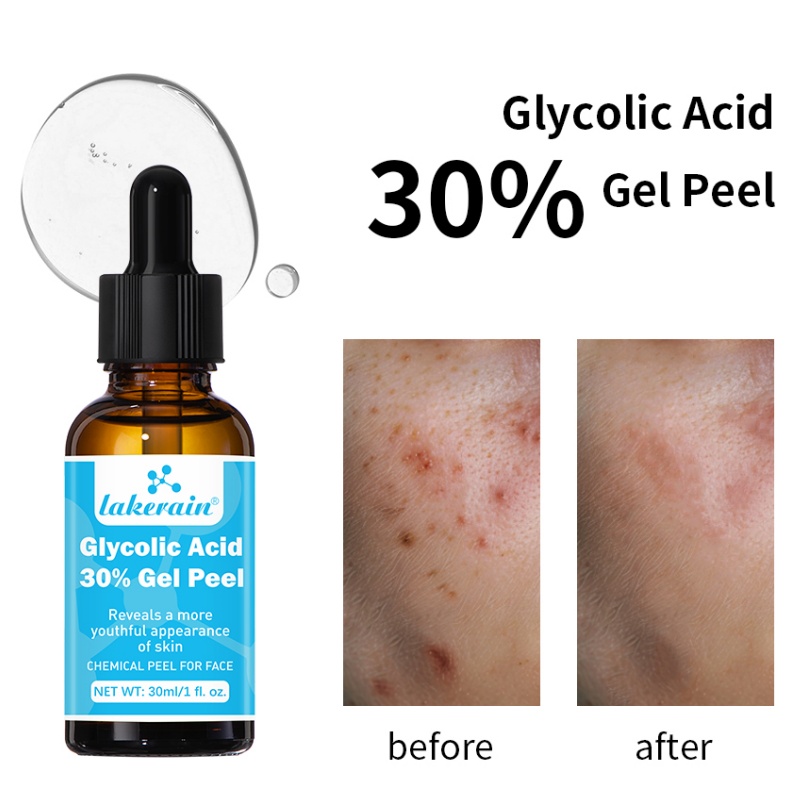 30% Glycolic Acid Peel Gel Pro - Lactic Acid Toner review and price